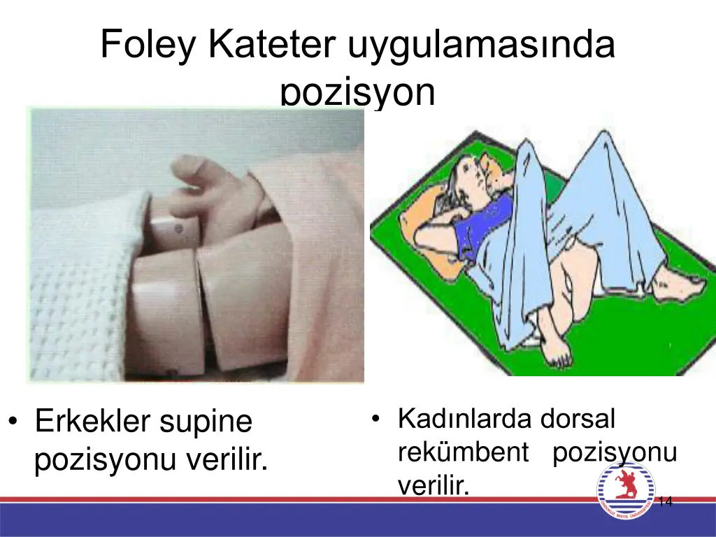 foley kateter uygulamas nda pozisyon