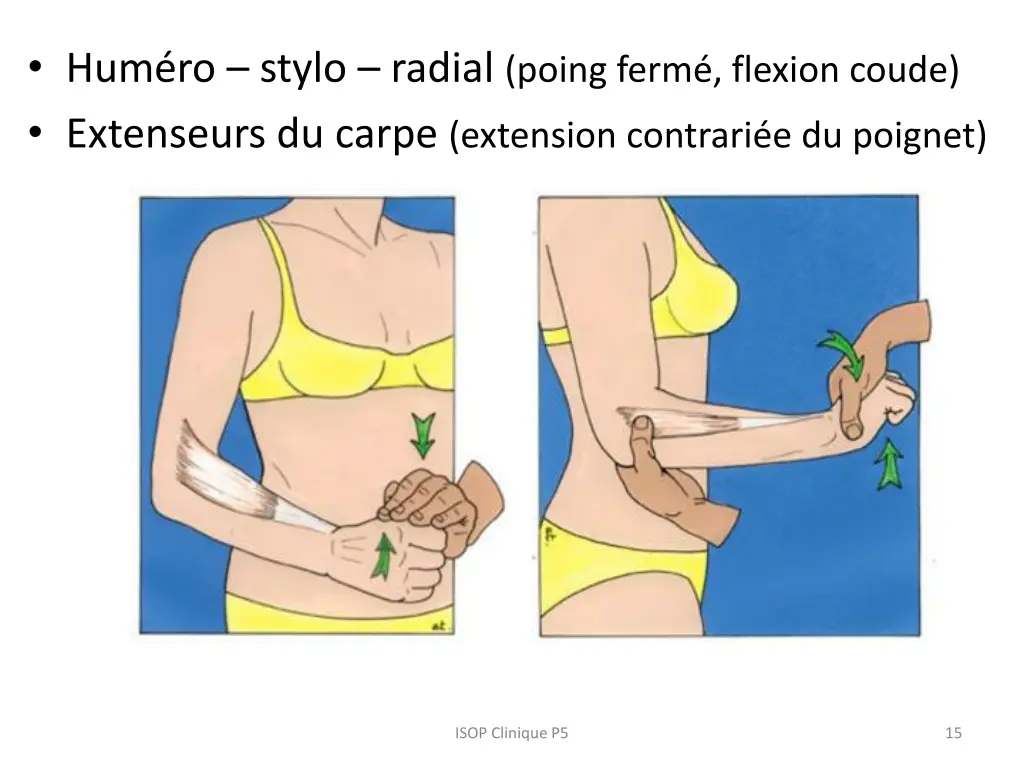hum ro stylo radial poing ferm flexion coude