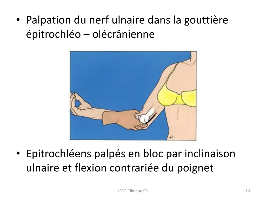 palpation du nerf ulnaire dans la goutti