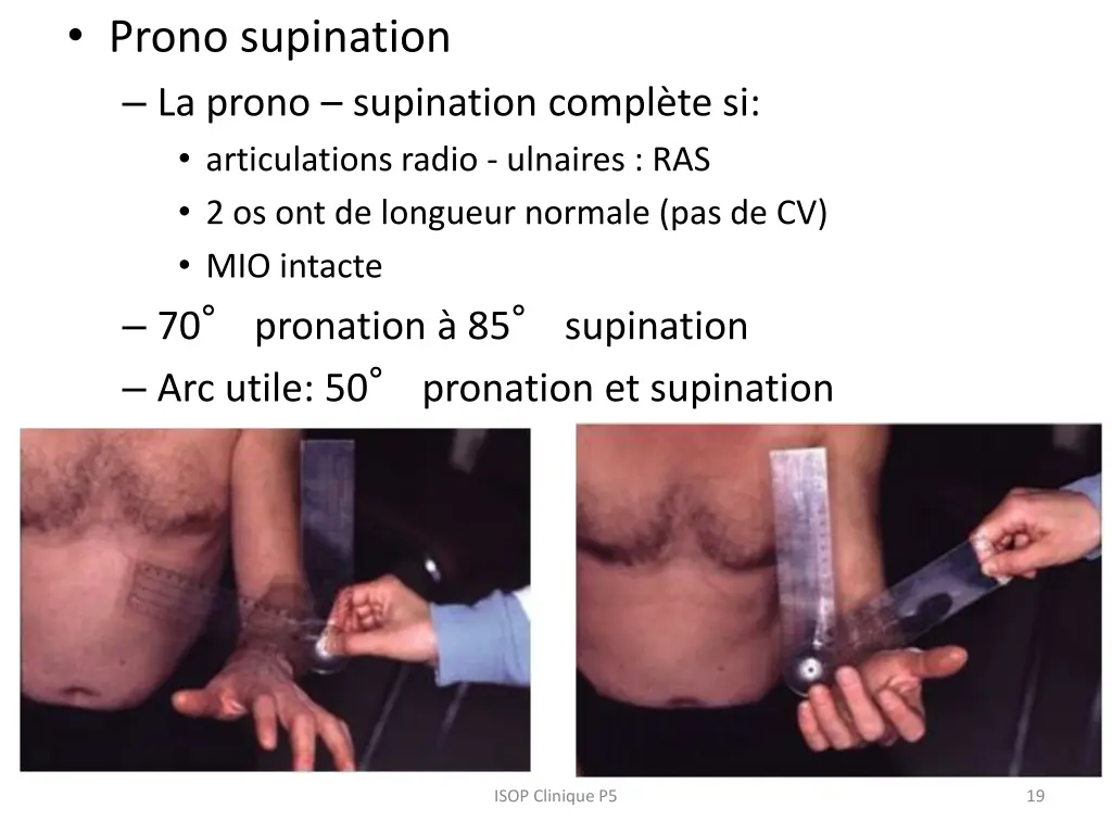prono supination la prono supination compl