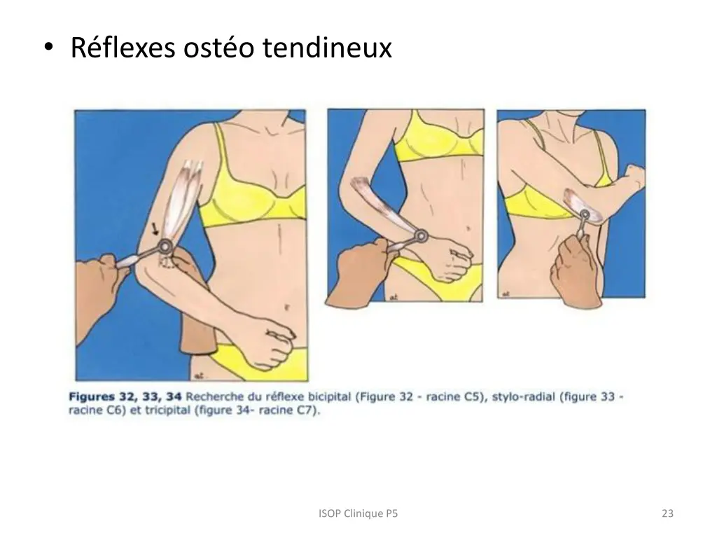 r flexes ost o tendineux