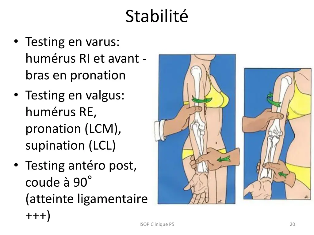 stabilit