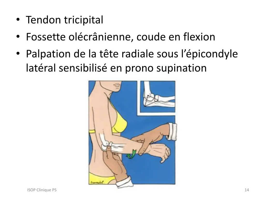 tendon tricipital fossette ol cr nienne coude