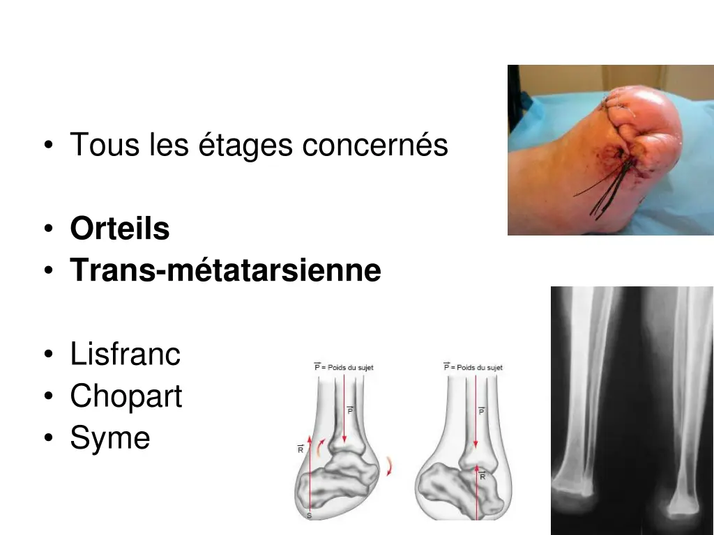 tous les tages concern s
