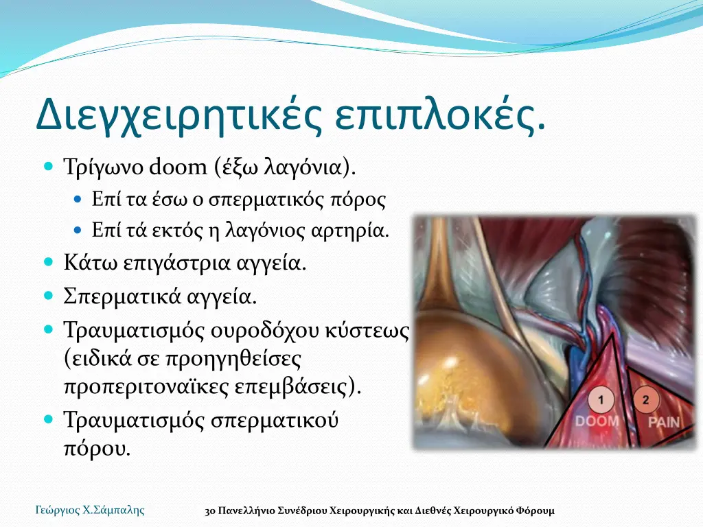 slide9