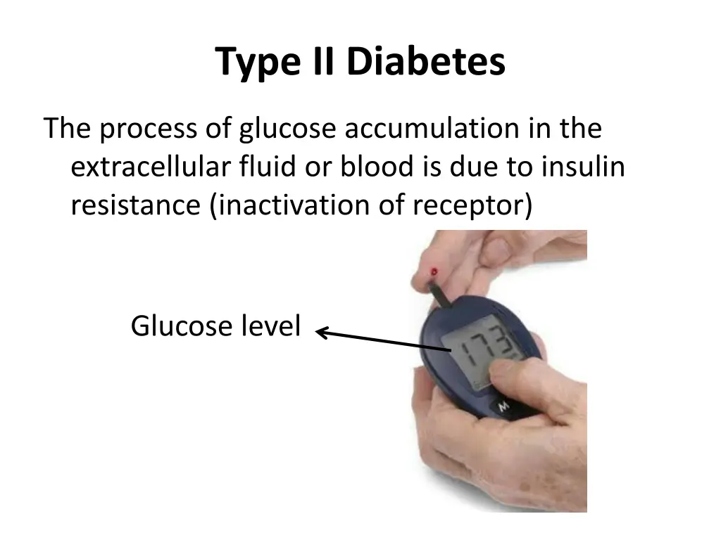 type ii diabetes