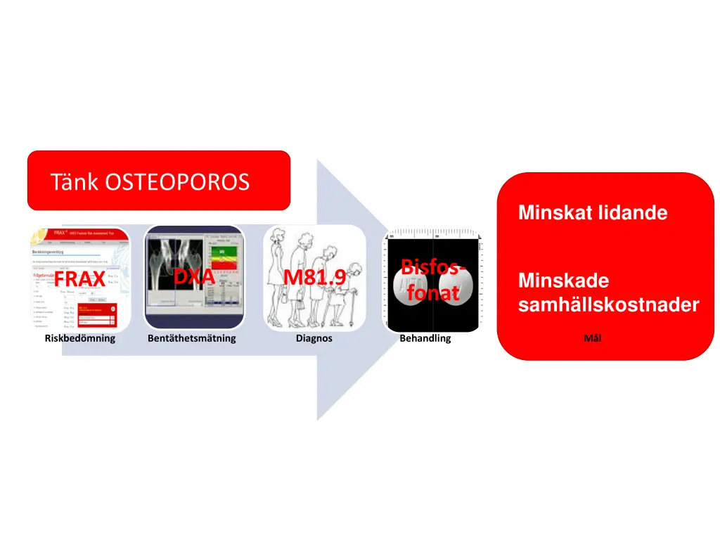 t nk osteoporos