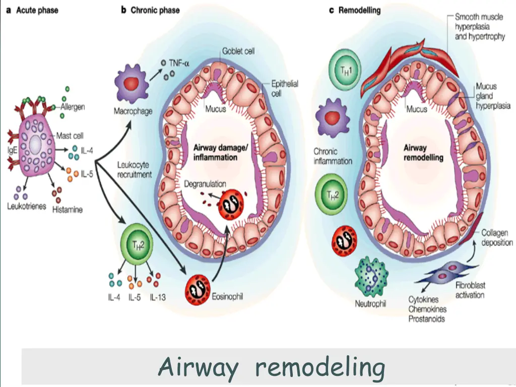 airway remodeling
