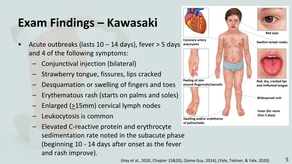 exam findings kawasaki