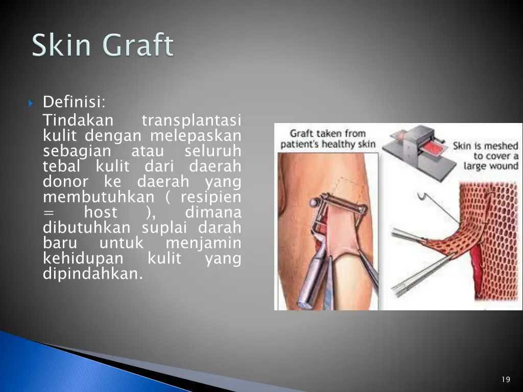 definisi tindakan kulit dengan melepaskan