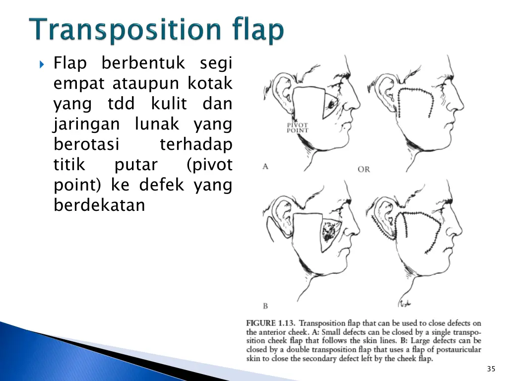 flap berbentuk segi empat ataupun kotak yang