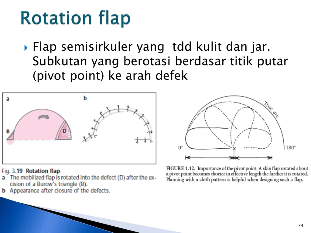 flap semisirkuler yang tdd kulit dan jar subkutan