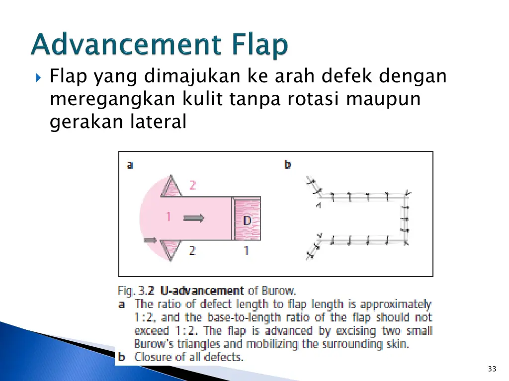 flap yang dimajukan ke arah defek dengan