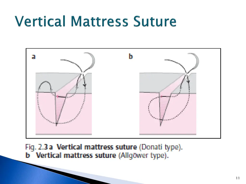 slide11