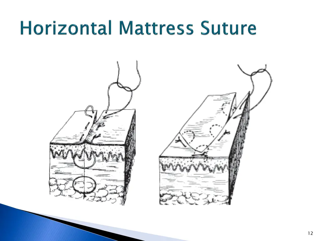 slide12