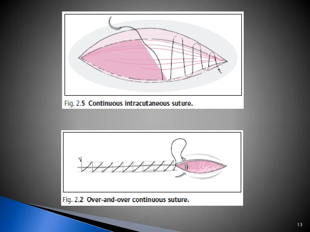 slide13