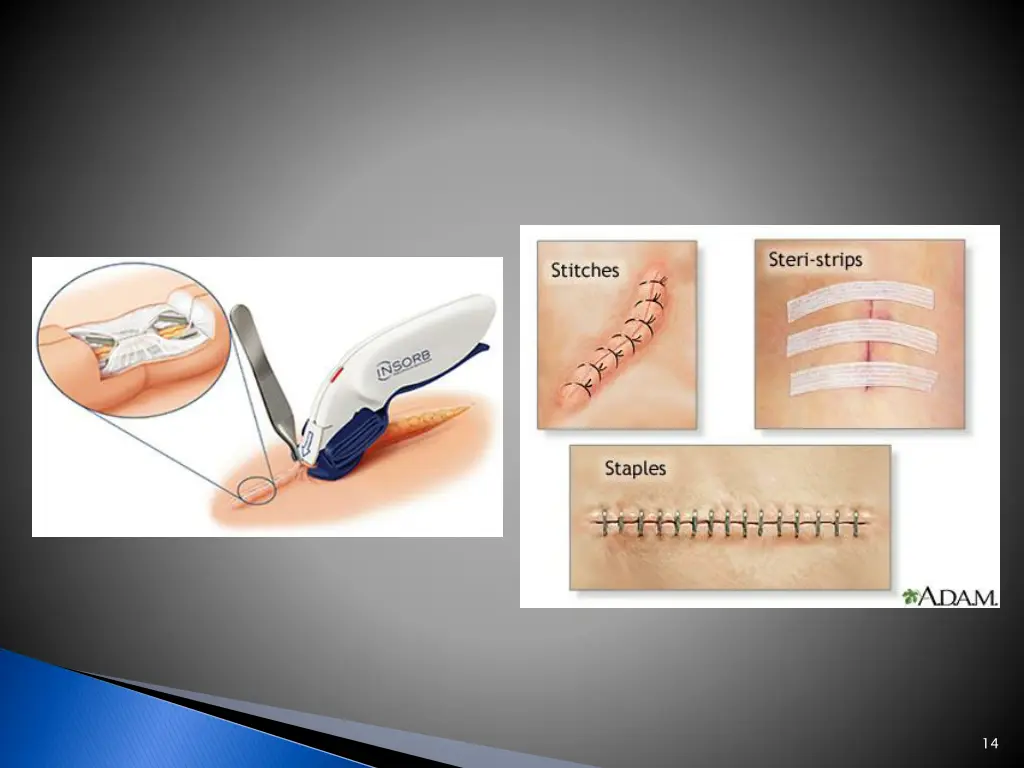 slide14