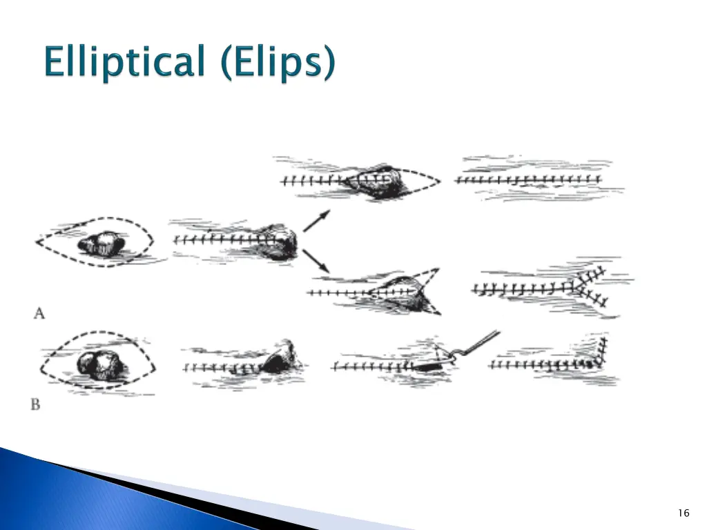 slide16