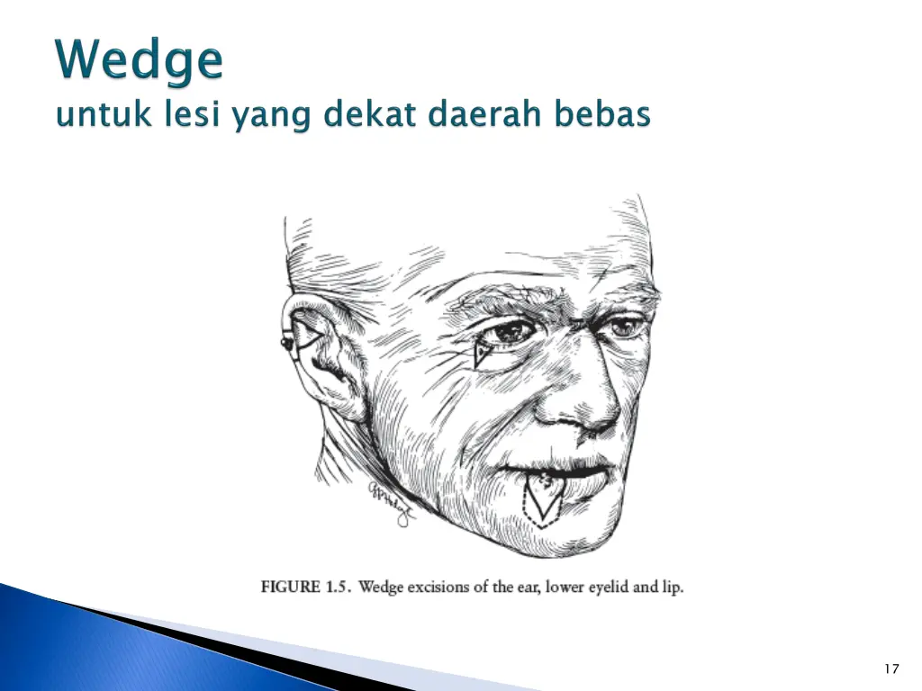 slide17