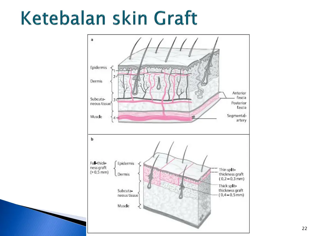 slide22