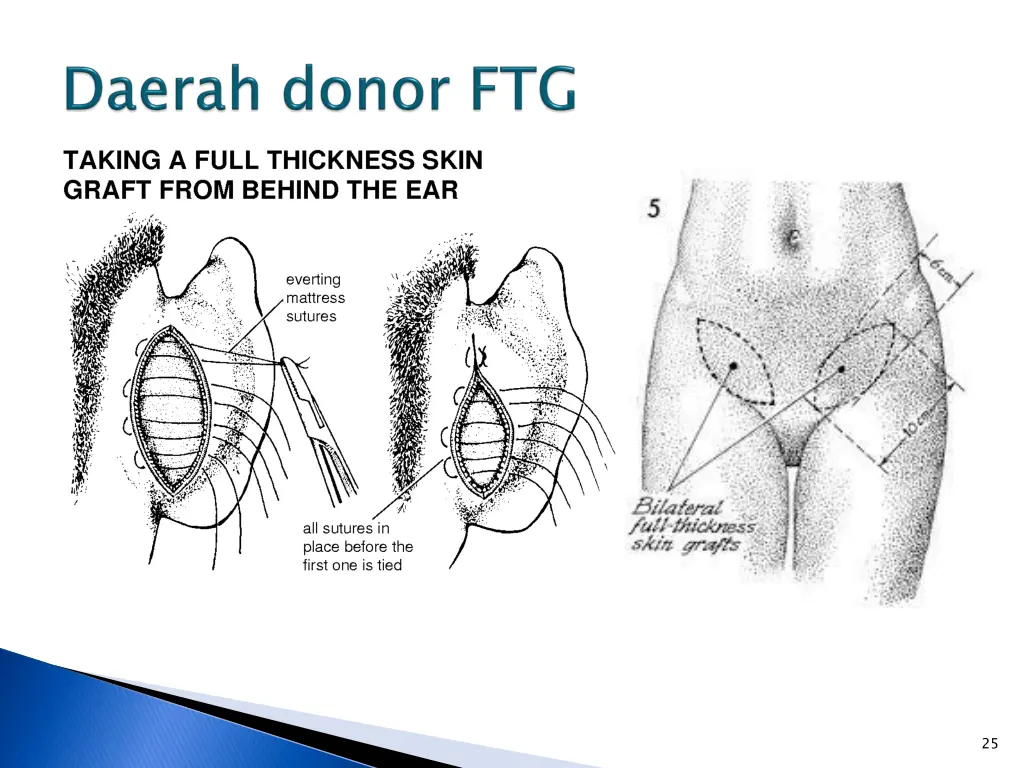 slide25