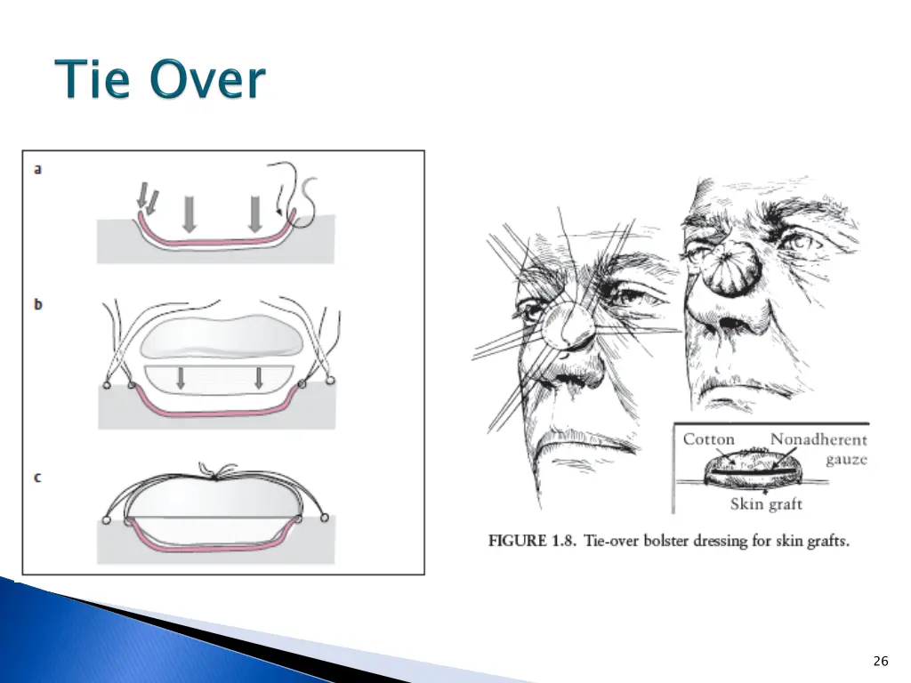 slide26