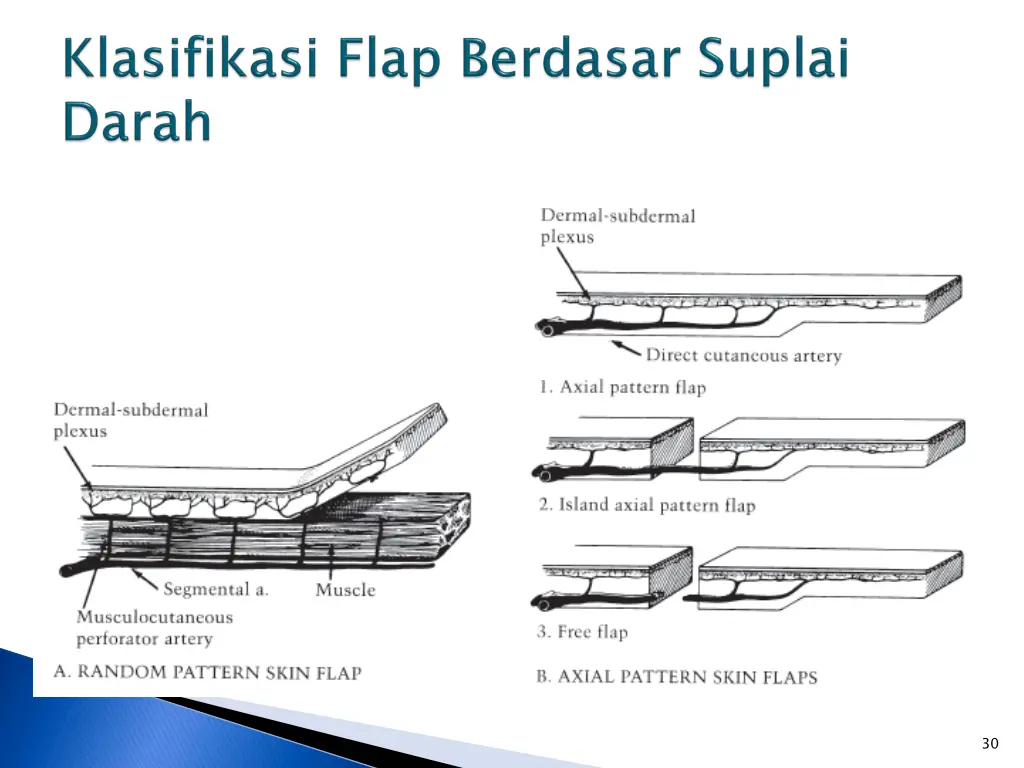 slide30