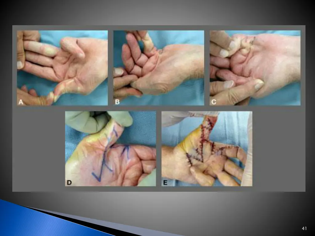 slide41