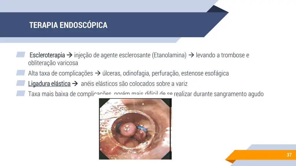 terapia endosc pica