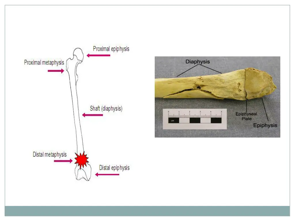 slide5