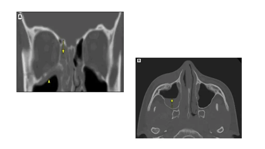 slide11