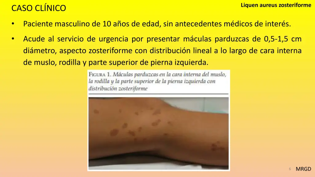 liquen aureus zosteriforme 3