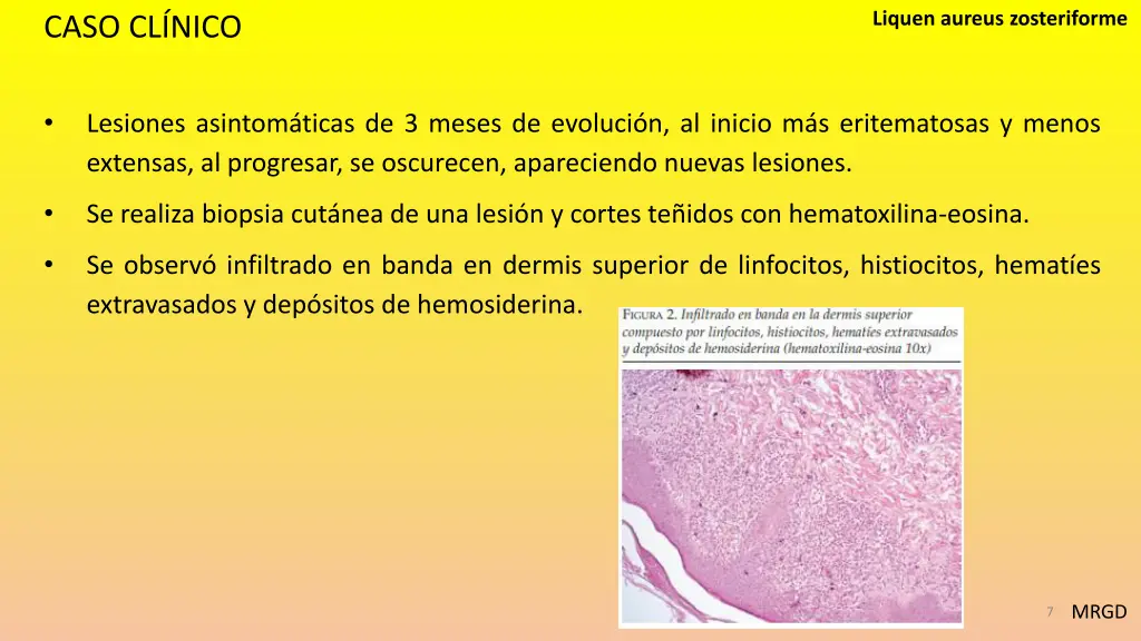 liquen aureus zosteriforme 4