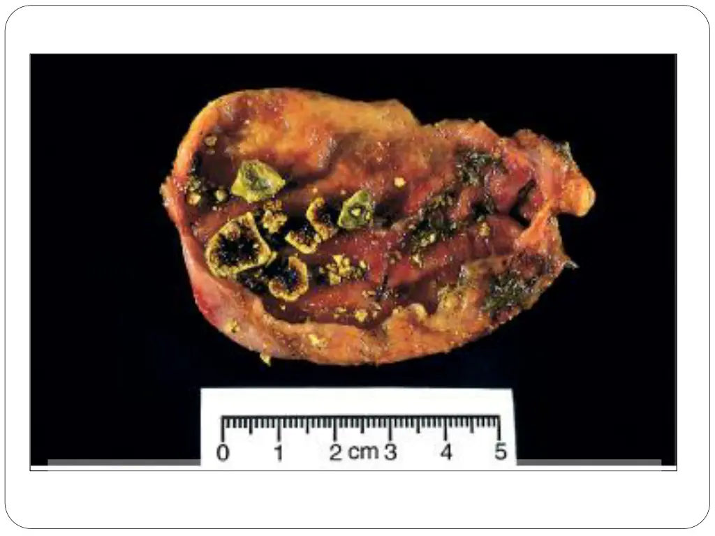 slide12