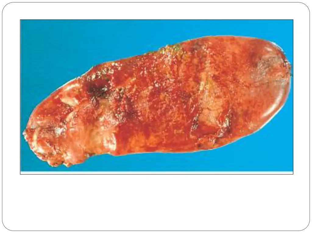 slide23