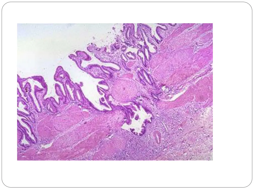 slide32