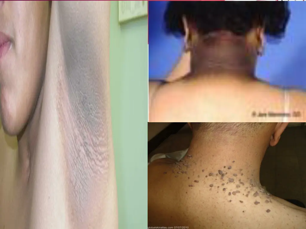 slide9