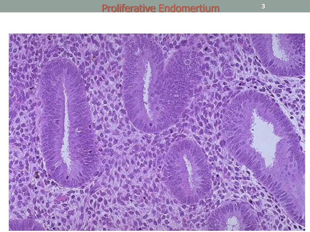 proliferative endomertium