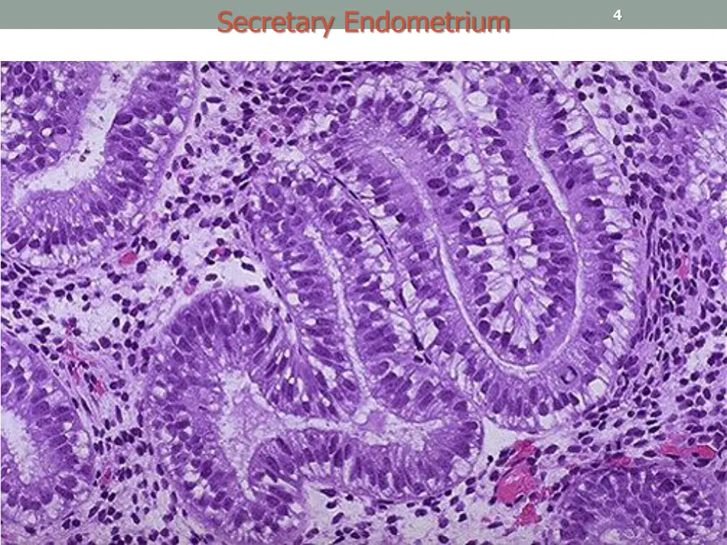 secretary endometrium