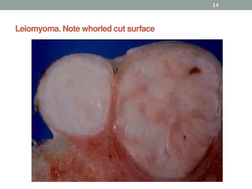 slide14