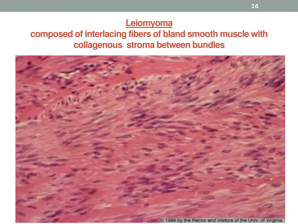 slide16