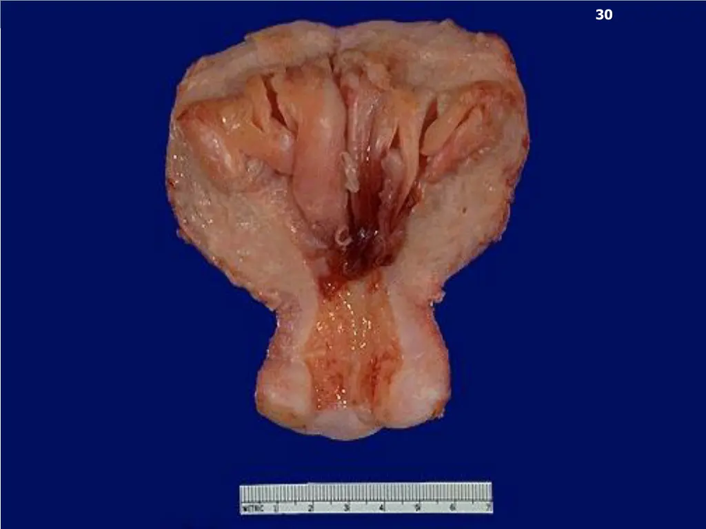 slide30
