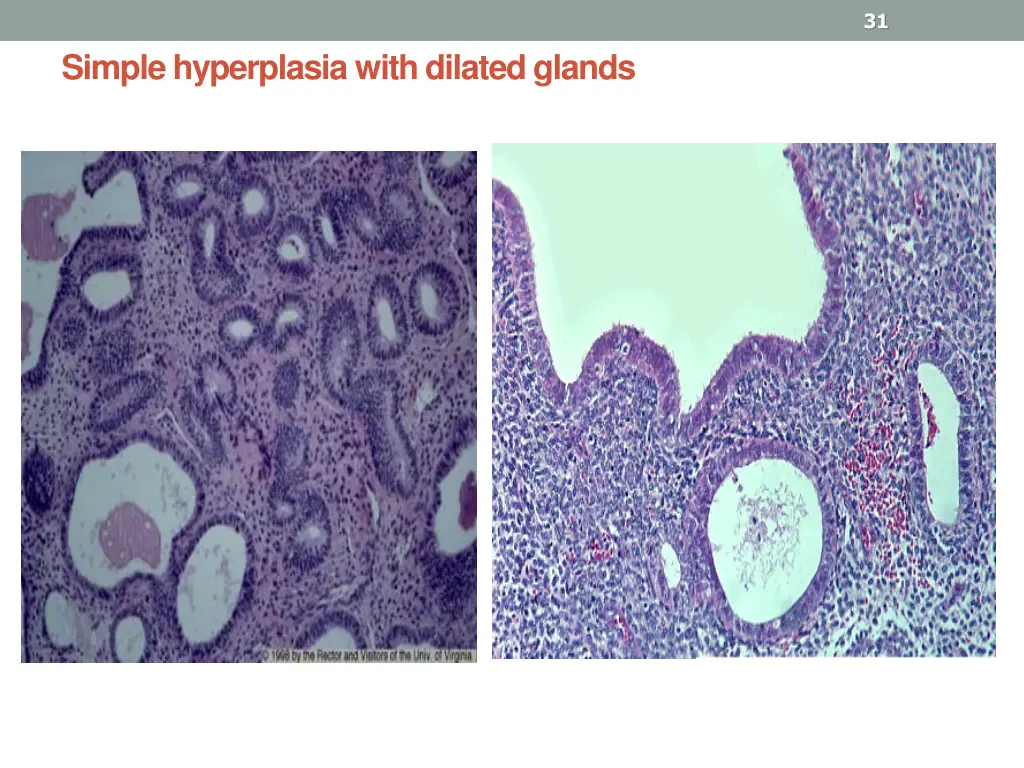 slide31