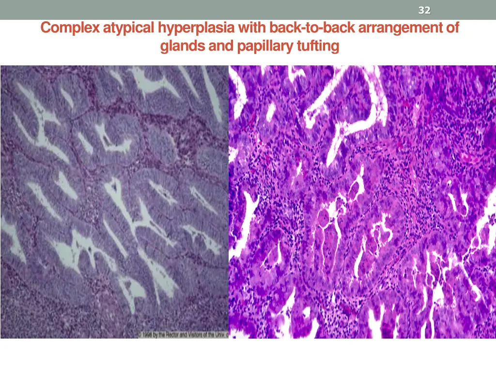 slide32