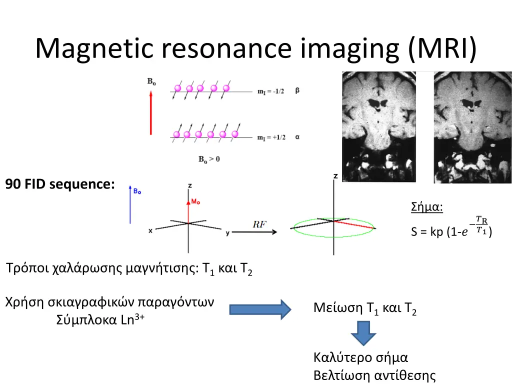 magnetic resonance imaging mri 1