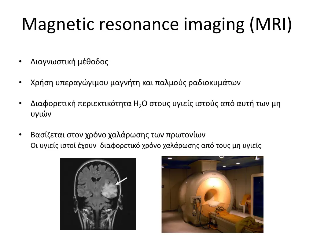magnetic resonance imaging mri