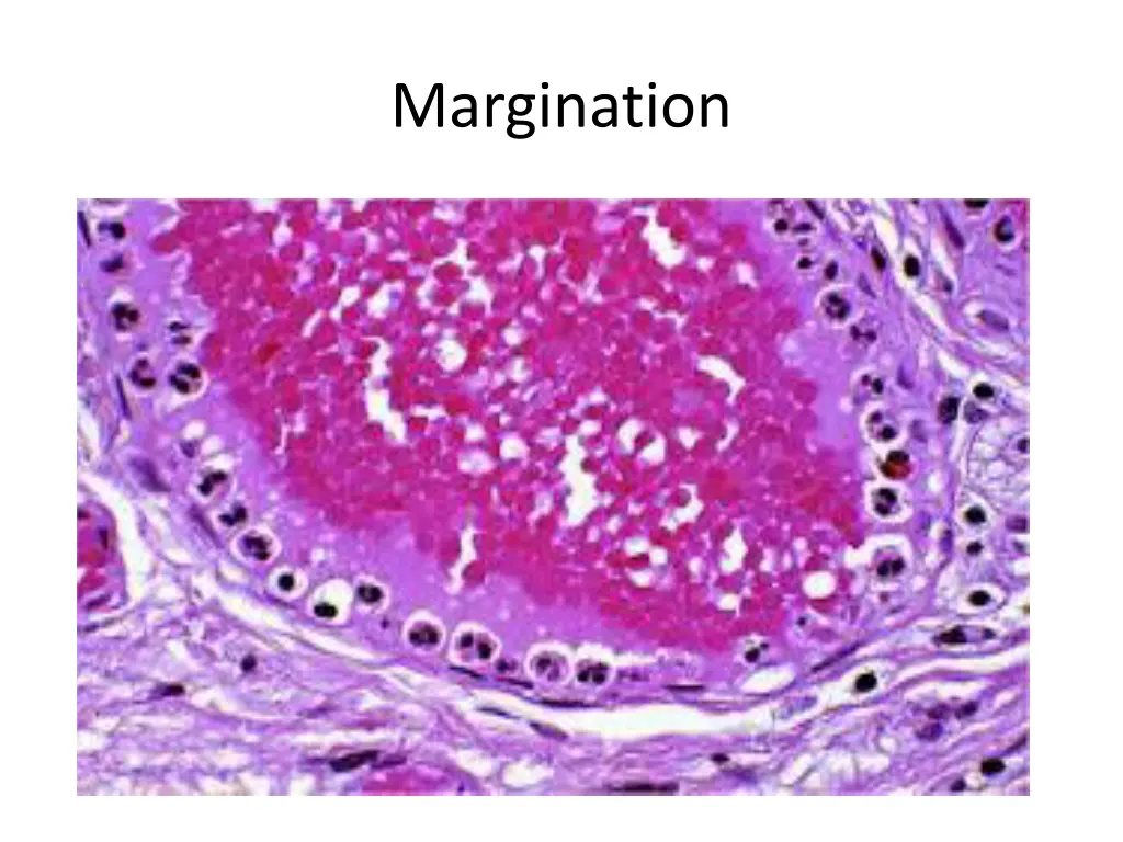 margination