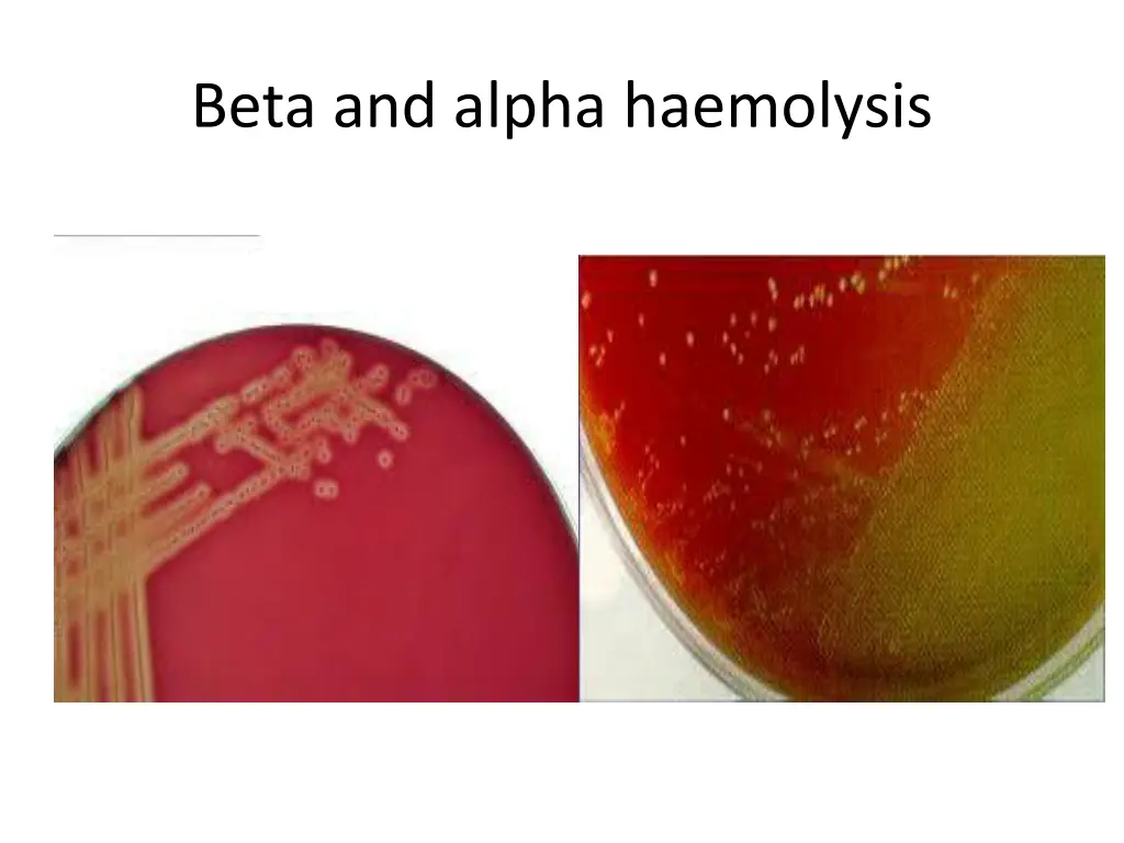 beta and alpha haemolysis