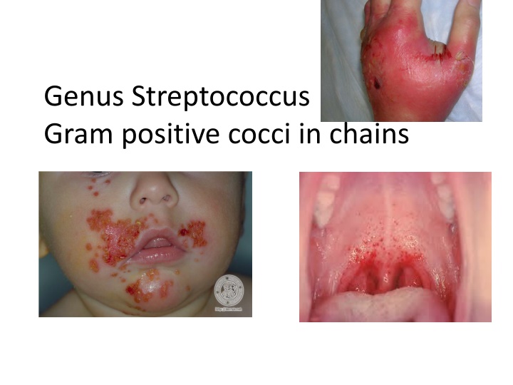 genus streptococcus gram positive cocci in chains
