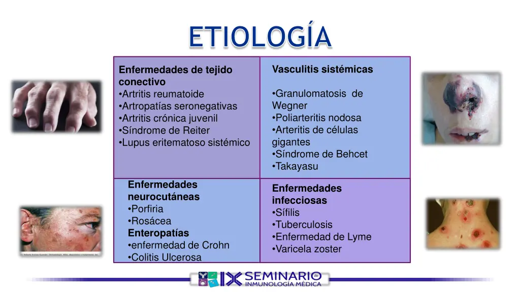 etiolog a